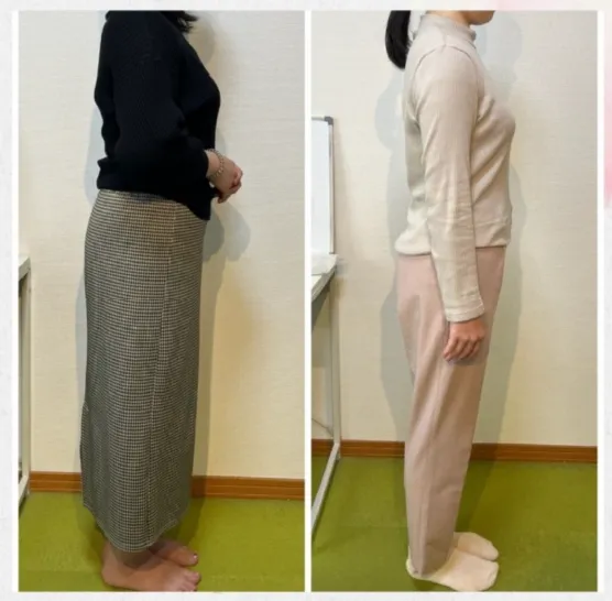 ビフォーアフター