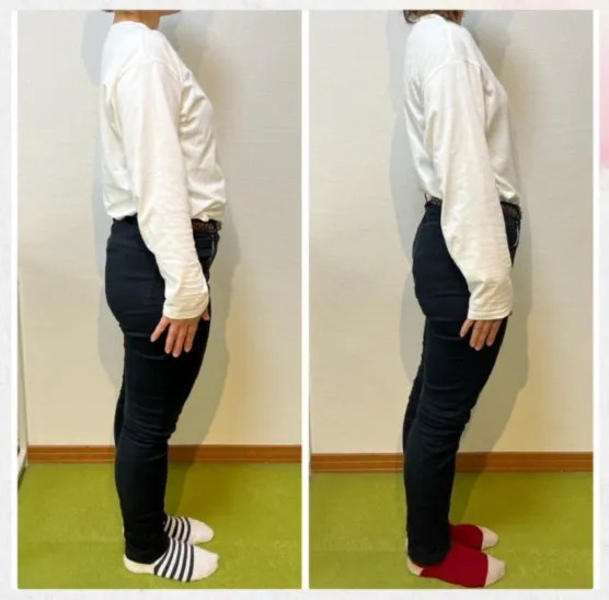 ビフォーアフター